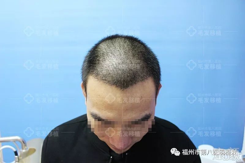 https://img.miyanlife.com/mnt/timg/171224/133PC292-5.jpg