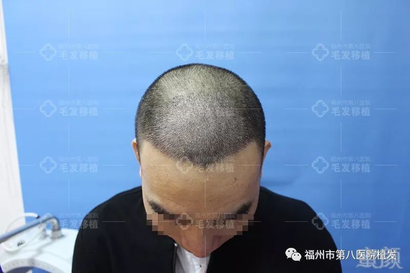 https://img.miyanlife.com/mnt/timg/171224/133PCQ8-4.jpg