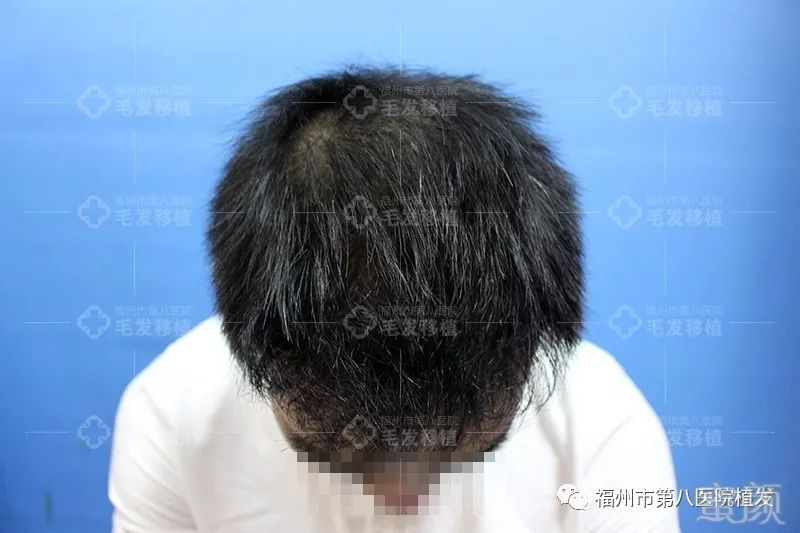 https://img.miyanlife.com/mnt/timg/171224/133PJ129-7.jpg