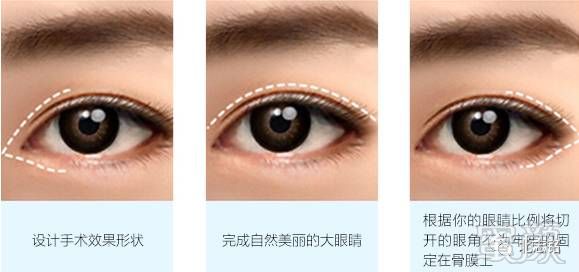 https://img.miyanlife.com/mnt/timg/171225/103U11028-2.jpg