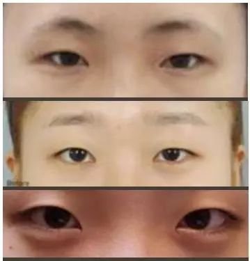 https://img.miyanlife.com/mnt/timg/171225/113H95135-2.jpg