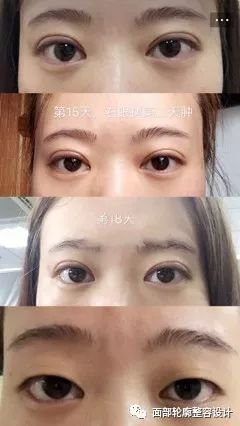https://img.miyanlife.com/mnt/timg/171226/1054511B0-0.jpg