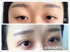 https://img.miyanlife.com/mnt/timg/171226/1055116203-0.jpg