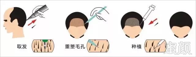 https://img.miyanlife.com/mnt/timg/171226/113T24O0-3.jpg