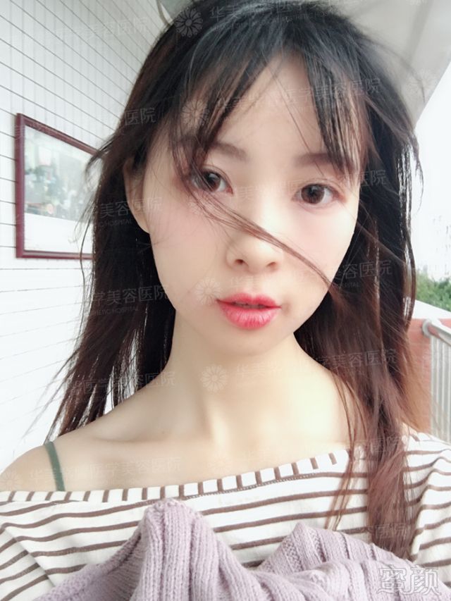 https://img.miyanlife.com/mnt/timg/171226/11532520S-7.jpg
