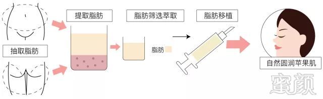 案例图片