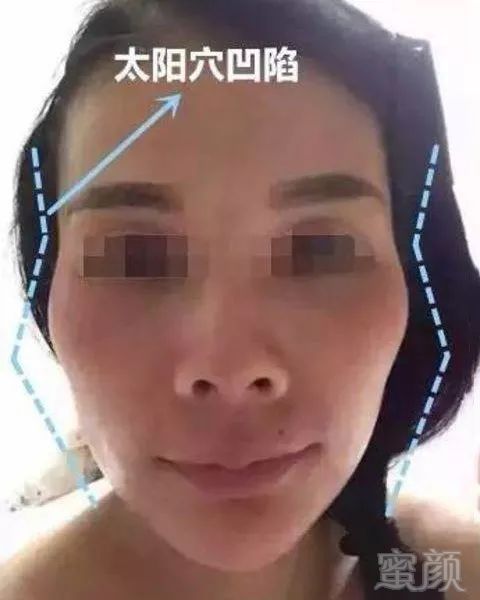 https://img.miyanlife.com/mnt/timg/171226/140I5G50-7.jpg