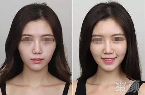 https://img.miyanlife.com/mnt/timg/171227/1123462U3-7.jpg