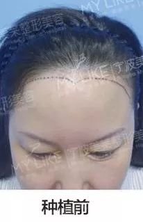 https://img.miyanlife.com/mnt/timg/171227/115I560X-10.jpg