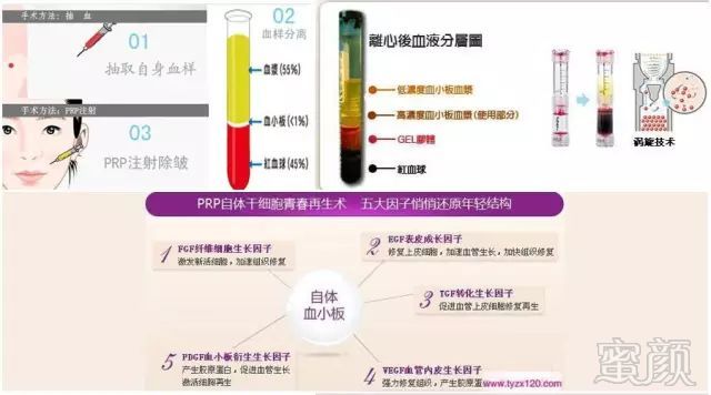 案例图片