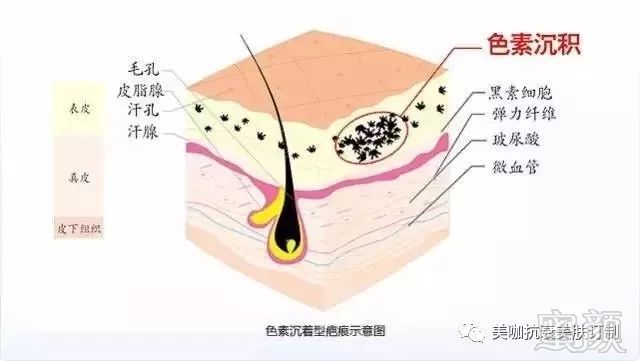 案例图片