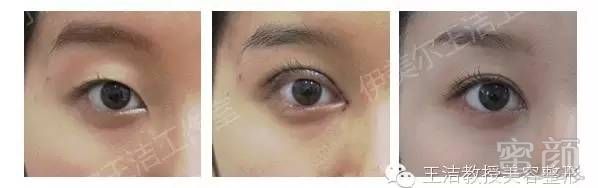 https://img.miyanlife.com/mnt/timg/171227/14313935I-10.jpg