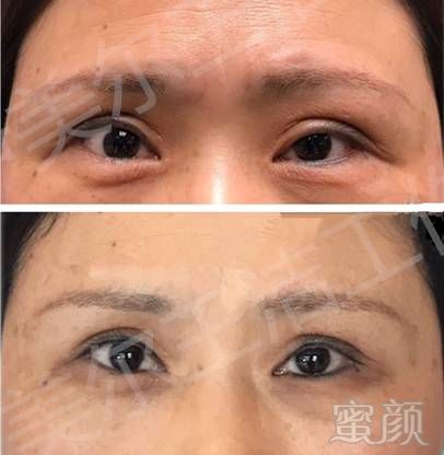 https://img.miyanlife.com/mnt/timg/171227/1431395608-9.jpg