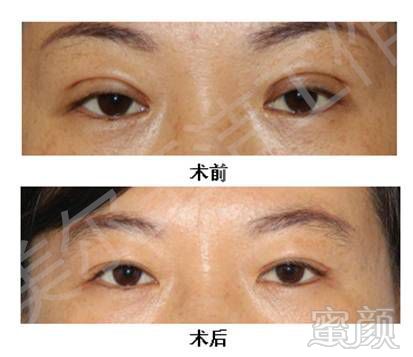 https://img.miyanlife.com/mnt/timg/171227/14313HH6-3.jpg
