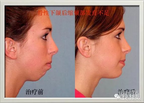 https://img.miyanlife.com/mnt/timg/171227/1432196335-8.jpg