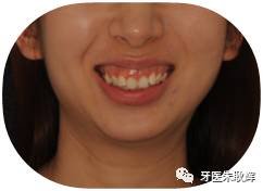 https://img.miyanlife.com/mnt/timg/171227/14321I635-2.jpg