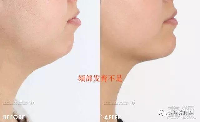 https://img.miyanlife.com/mnt/timg/171227/143220L59-10.jpg