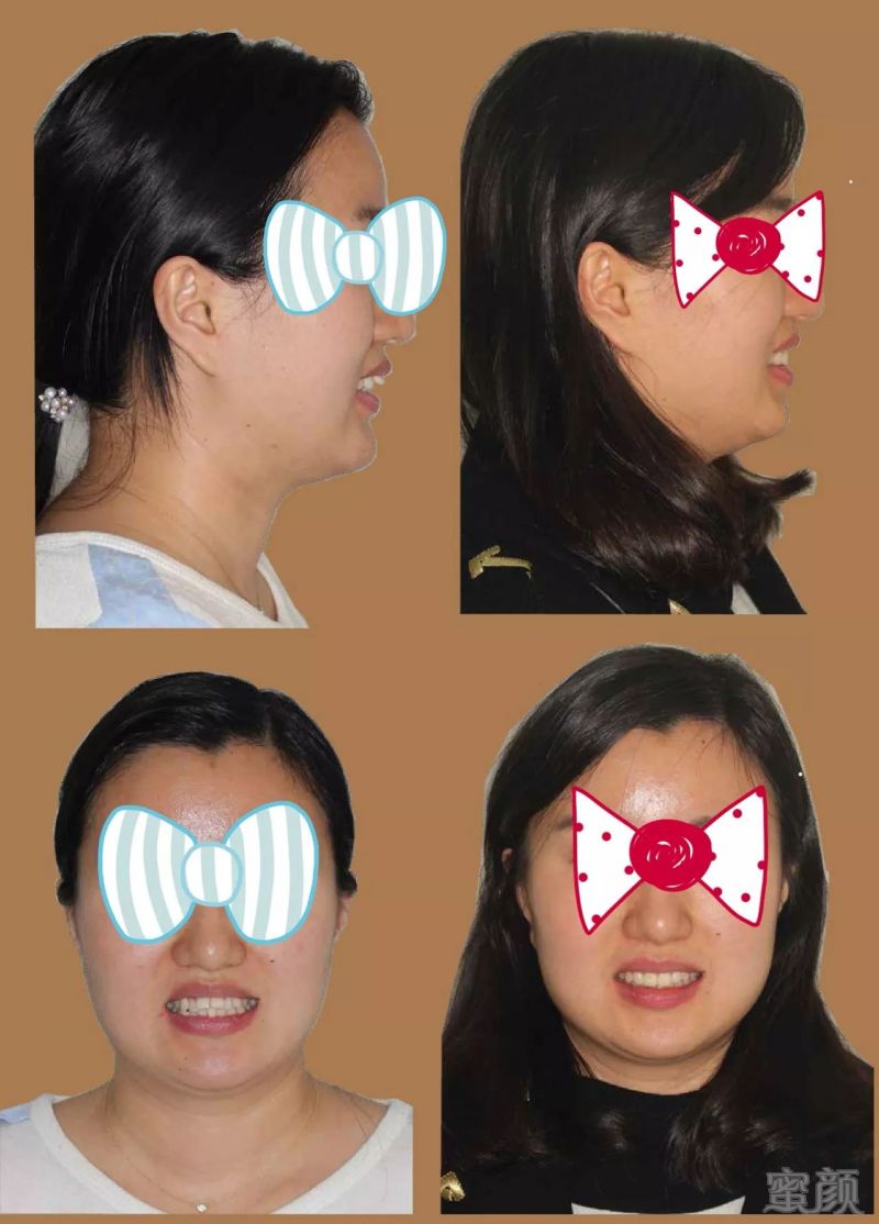 https://img.miyanlife.com/mnt/timg/171228/1110235933-5.jpg