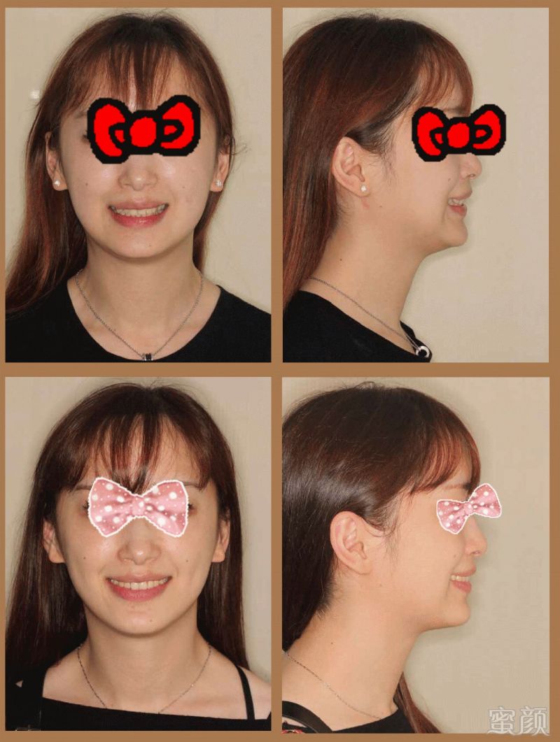 https://img.miyanlife.com/mnt/timg/171228/111023L31-6.jpg