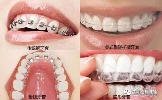 https://img.miyanlife.com/mnt/timg/171228/1131004226-2.jpg