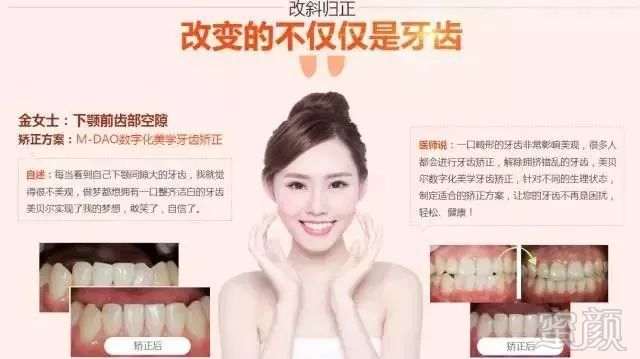 https://img.miyanlife.com/mnt/timg/171228/1200501427-3.jpg