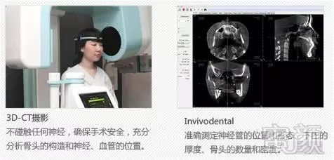 https://img.miyanlife.com/mnt/timg/171228/120J61F0-4.jpg