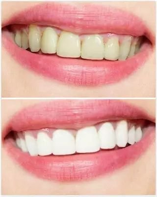 https://img.miyanlife.com/mnt/timg/171228/1354301440-10.jpg