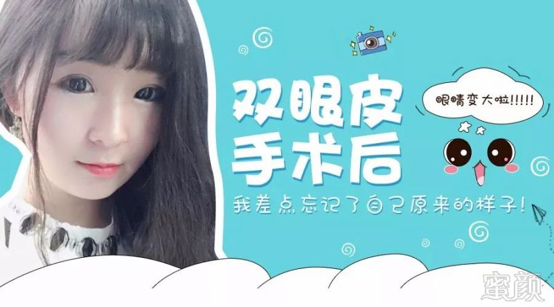 https://img.miyanlife.com/mnt/timg/171228/1412302I3-0.jpg