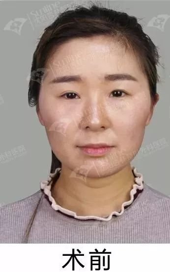 https://img.miyanlife.com/mnt/timg/171228/141231C26-2.jpg