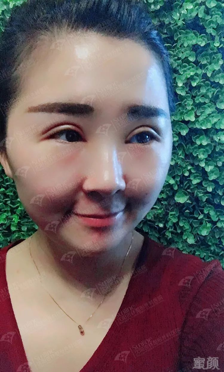 https://img.miyanlife.com/mnt/timg/171228/1412322543-5.jpg