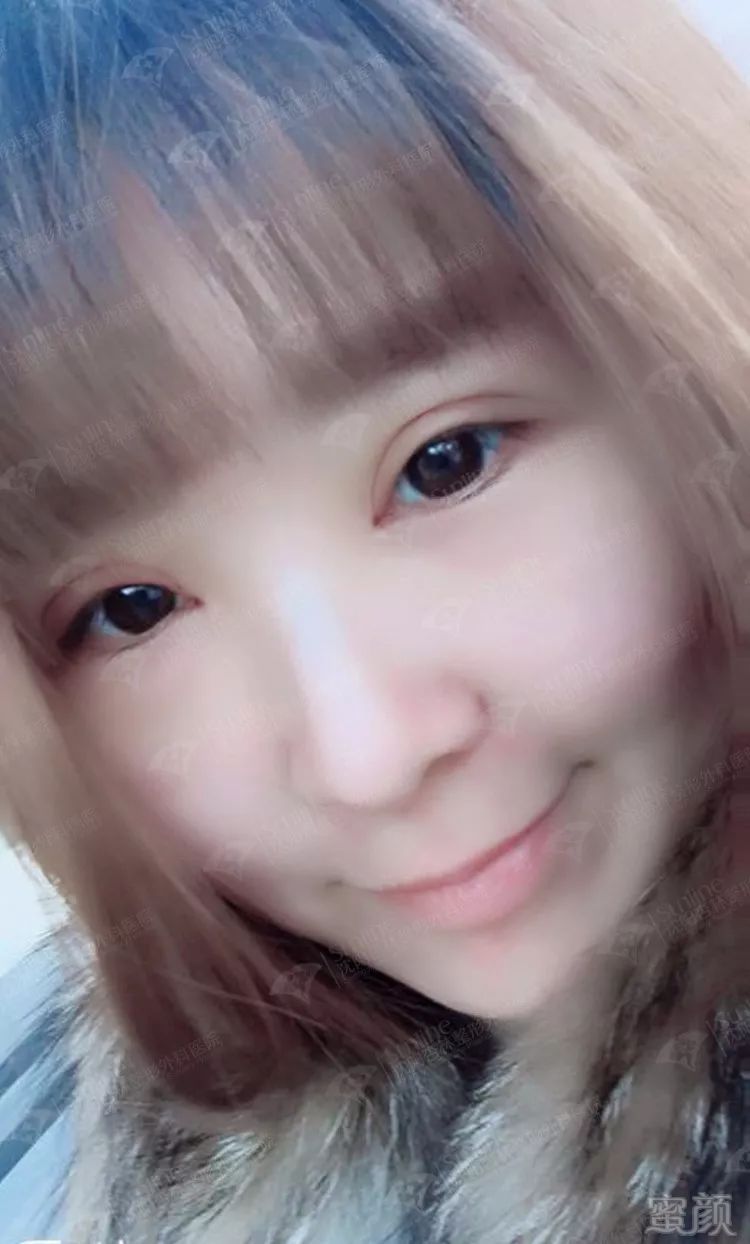https://img.miyanlife.com/mnt/timg/171228/1412344611-8.jpg