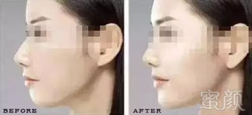 https://img.miyanlife.com/mnt/timg/171229/095A34E6-2.jpg