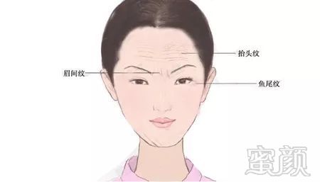 https://img.miyanlife.com/mnt/timg/171229/102J54235-4.jpg