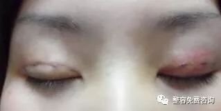 https://img.miyanlife.com/mnt/timg/171229/1054223D3-2.jpg