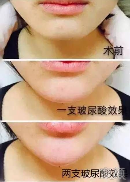 https://img.miyanlife.com/mnt/timg/171229/113312FX-5.jpg