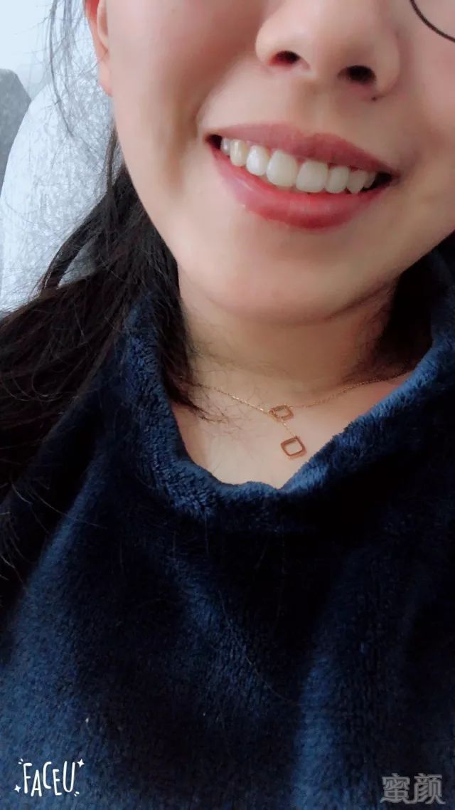 https://img.miyanlife.com/mnt/timg/171229/1205464318-4.jpg