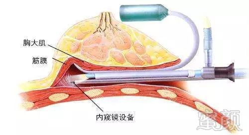 案例图片