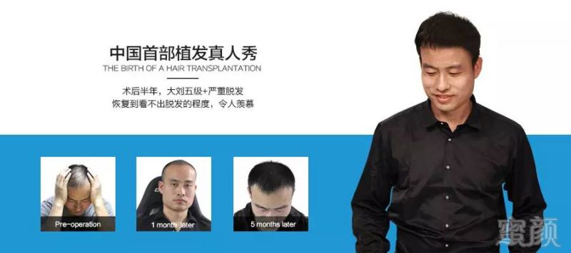 https://img.miyanlife.com/mnt/timg/171229/130K42958-12.jpg