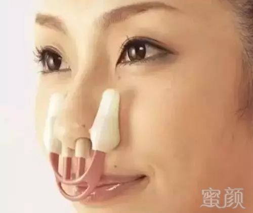 https://img.miyanlife.com/mnt/timg/171229/13223163L-9.jpg