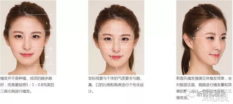 https://img.miyanlife.com/mnt/timg/171229/13594262T-1.jpg
