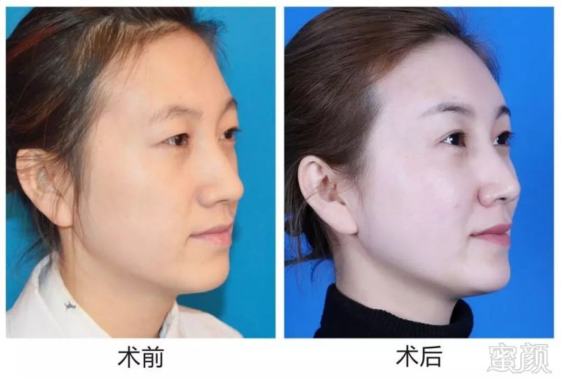 https://img.miyanlife.com/mnt/timg/171229/141I0O46-4.jpg