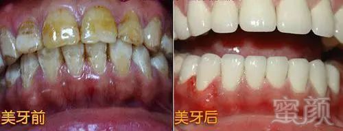 https://img.miyanlife.com/mnt/timg/171229/1520411403-3.jpg