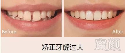 https://img.miyanlife.com/mnt/timg/171229/1520416430-5.jpg