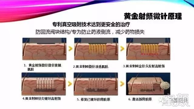 https://img.miyanlife.com/mnt/timg/171230/114H0J58-2.jpg