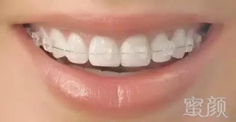 https://img.miyanlife.com/mnt/timg/171230/1325353517-3.jpg