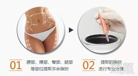 https://img.miyanlife.com/mnt/timg/171230/1353192435-10.jpg
