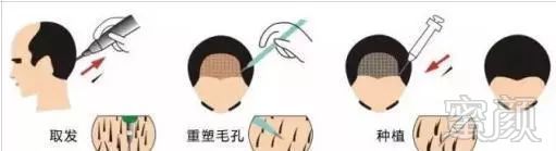 https://img.miyanlife.com/mnt/timg/171230/1403063551-0.jpg