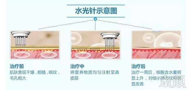 https://img.miyanlife.com/mnt/timg/171230/14033015H-7.jpg