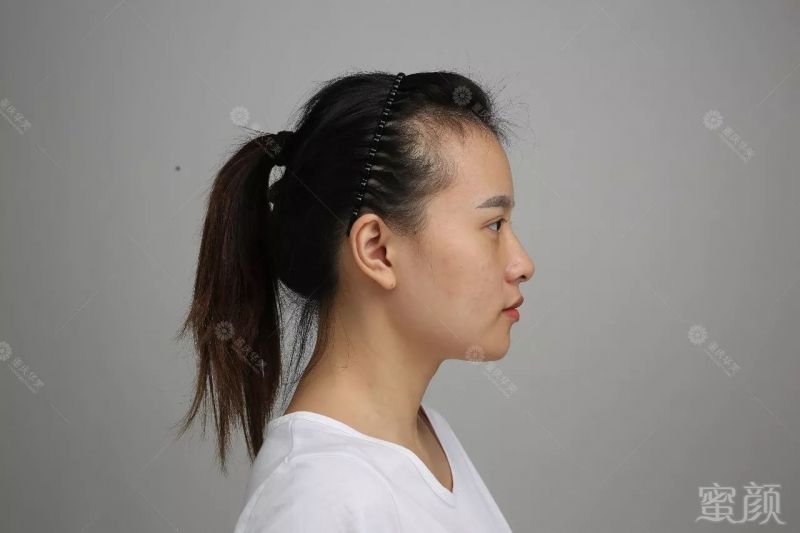 https://img.miyanlife.com/mnt/timg/171230/14054633P-3.jpg