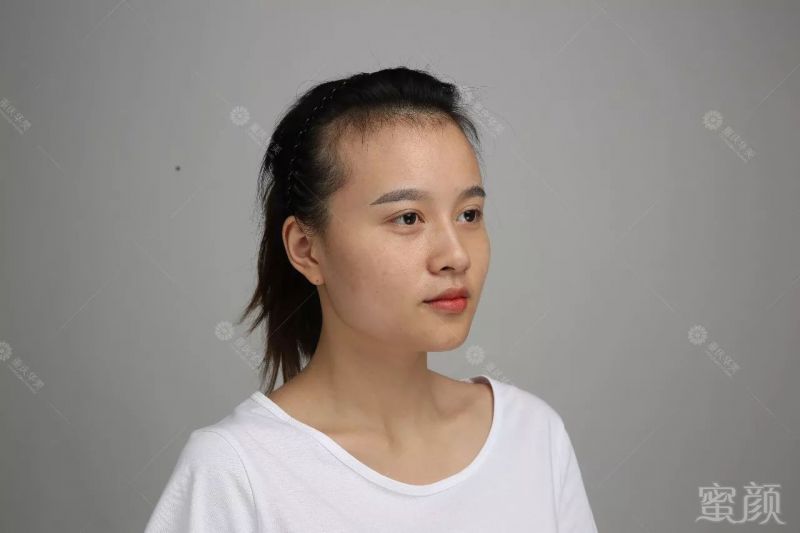 https://img.miyanlife.com/mnt/timg/171230/14054A037-2.jpg
